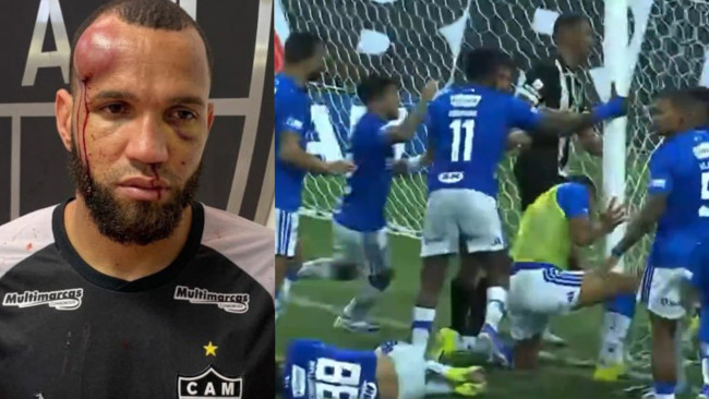 Pertarungan lapangan brutal di Brasil berakhir dengan 23 pemain dikeluarkan dari lapangan dan cedera parah