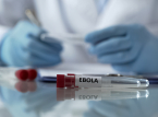 Para pemimpin G7 berkomitmen untuk respons terkoordinasi terhadap wabah Ebola yang muncul kembali di DR Kongo dan Uganda