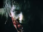 Tingkat kesadisan di Resident Evil 2 akan "membuatmu takut setengah mati"