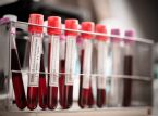 Intelijen Jerman menunjukkan COVID-19 kemungkinan lolos dari laboratorium Tiongkok