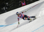 Pemain ski Amerika Lindsey Vonn menjalani operasi ketiga di kakinya